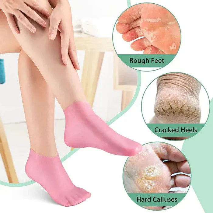 1 Pair Silicone Heel Protectors