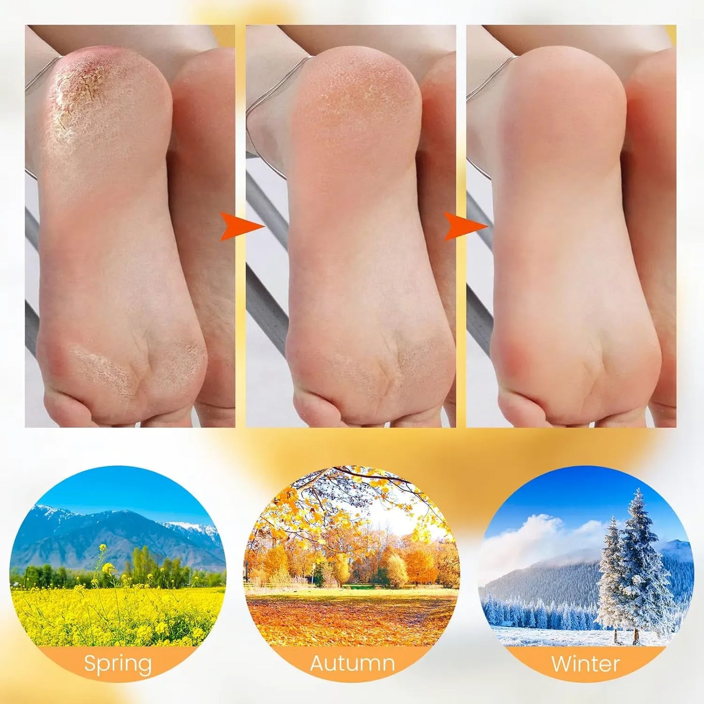 1 Pair Silicone Heel Protectors